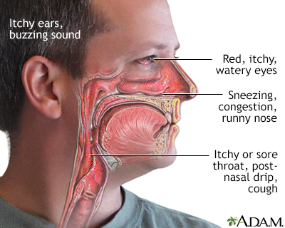 40+ Post nasal drip ear pain