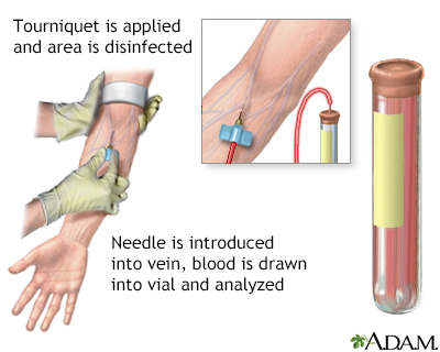 Blood test