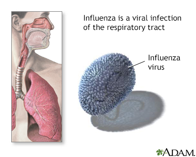 Influenza